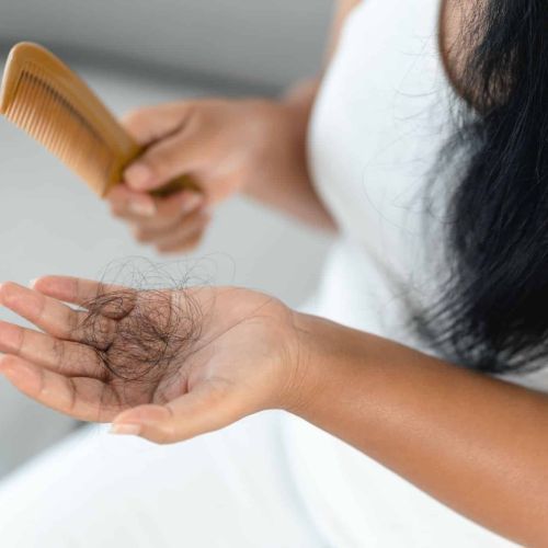 What Hair Loss is Telling You About Your Hormone Levels, AARx in Tampa Bay and Central Florida
