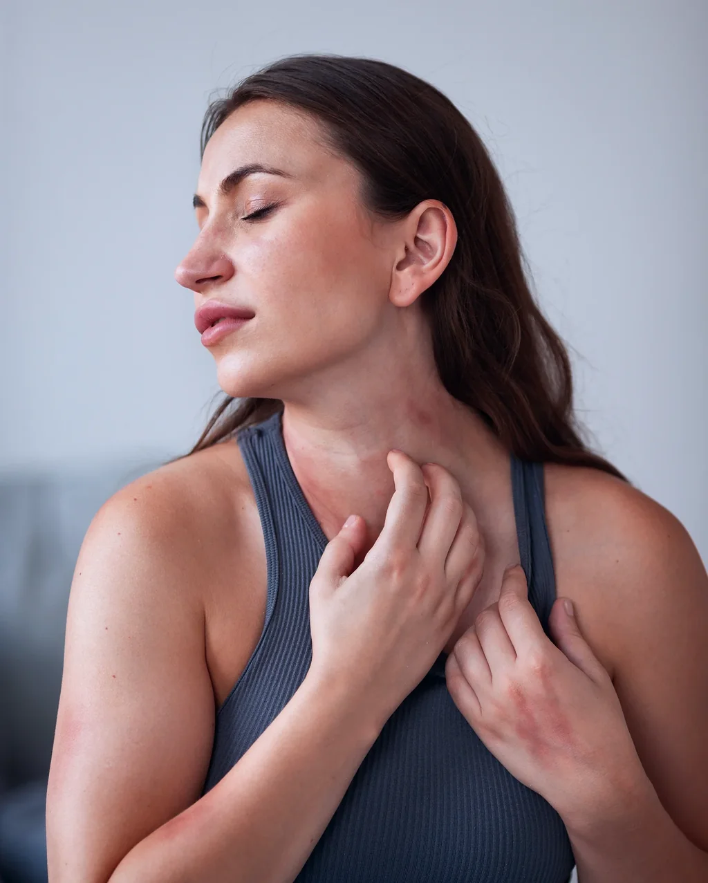 Psoriasis at AARx